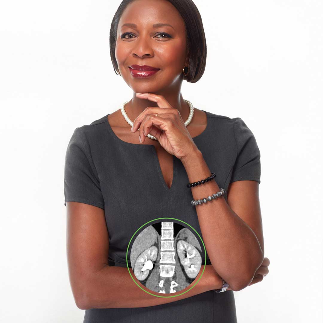 An African American woman smiling with an MRI overlay showing her organs clearly.