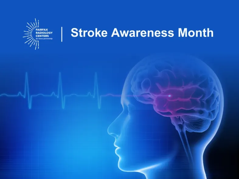 Stroke Awareness Month: Why “Time Is Brain” and How Imaging Can Help Prevent Stroke